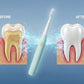 Electric Toothbrush – Long Battery Edition- FL